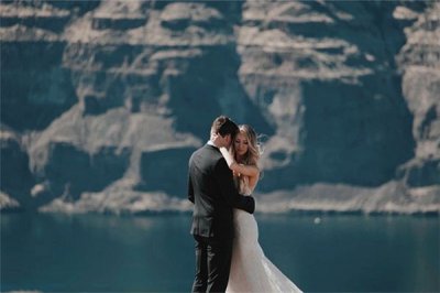 ​男人右边太阳有痣好吗