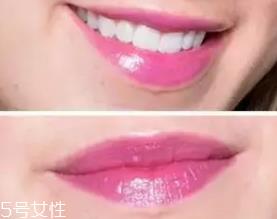 唇釉适合哪些人用?唇纹深的人 唇釉适合哪些人用?唇纹深的人
