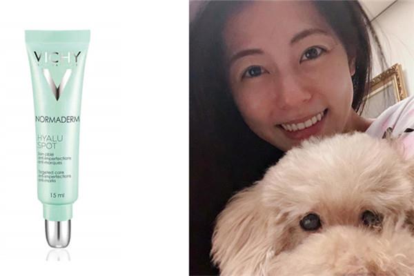 哪款抗痘精华厉害 突然冒痘了怎么办 哪款抗痘精华厉害 突然冒痘了怎么办