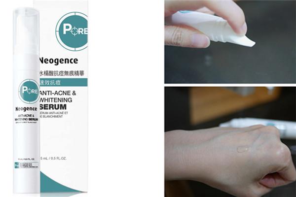 哪款抗痘精华厉害 突然冒痘了怎么办 哪款抗痘精华厉害 突然冒痘了怎么办