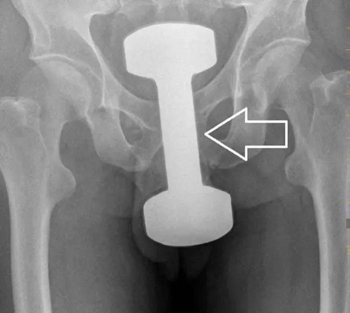 他们往下面塞的这些东西,竟藏着成年人“羞于启齿”的秘密...