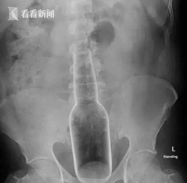 他们往下面塞的这些东西,竟藏着成年人“羞于启齿”的秘密...