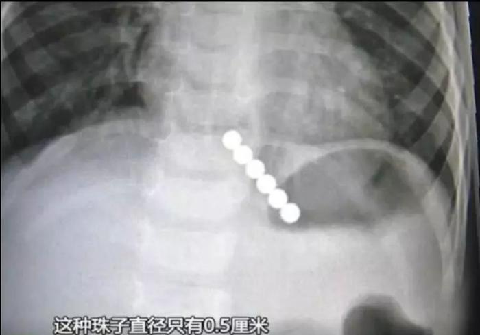 他们往下面塞的这些东西,竟藏着成年人“羞于启齿”的秘密...