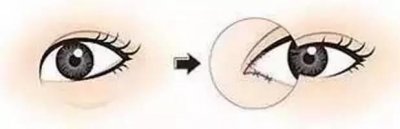 ​一单一双的眼睛有什么说法 眼皮一单一双 从面相