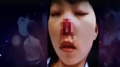 ​男子咬掉妻子器官并吞下，照片曝光，网友：太惨了！