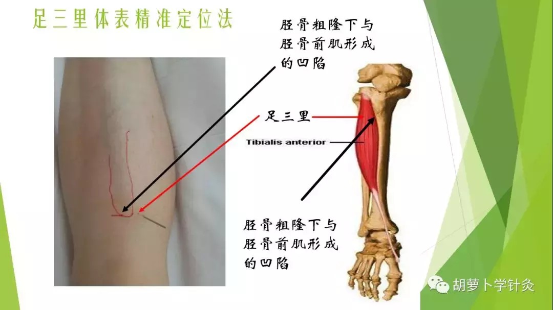 用这个方法，100%找准足三里
