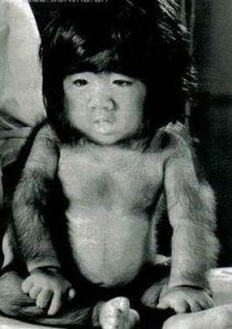 ​中国第一毛孩：因丑挨打，被老板逼着脱衣露毛，成名背后受尽歧视