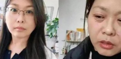 ​女子自称20天内“老了30多岁”，专家：“断崖式衰老”男女都会有