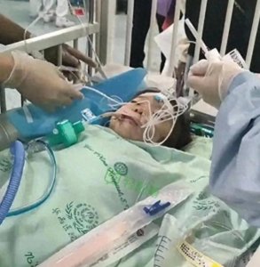 ​比成都被咬女孩还可怜，河南一岁宝宝被狗咬掉半张脸维权4年未果